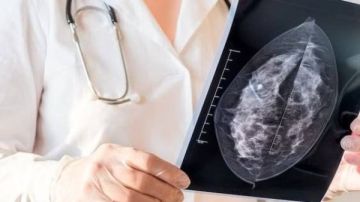 دراسة جديدة تحذر: تأجيل أول فحص ماموجرام يزيد خطر الوفاة بسرطان الثدي 40 