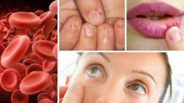 الشعور المستمر بالإرهاق.. نقص الحديد في الجسم أحد الأسباب