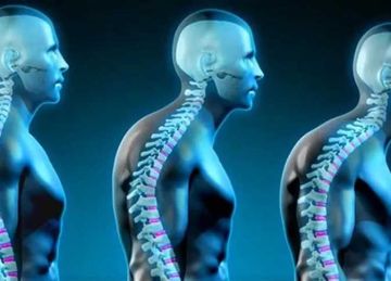 في يوم التوعية بصحة العمود الفقري.. نصائح للوقاية من آلام الظهر والرقبة في يوم التوعية بصحة العمود الفقري.. نصائح للوقاية من آلام الظهر والرقبة