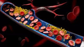 ارتفاع الكوليسترول في الدم.. أسبابه وأعراضه وطرق الوقاية والعلاج