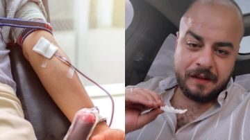 طبيب يفجر مفاجأة.. لماذا لا يجب التبرع بالدم عقب زيارة عيادات الأسنان؟