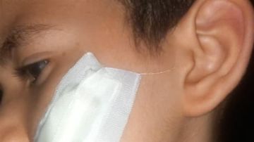 حقيقة اعتداء طالب على زميله بـكتر داخل مدرسة في حلوان حقيقة اعتداء طالب على زميله بـكتر داخل مدرسة في حلوان