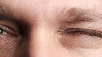 هل شعرت يوما بارتعاش في جفن عينيك؟.. كل ما تود معرفته هل شعرت يوما بارتعاش في جفن عينيك؟.. كل ما تود معرفته