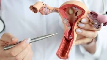 كيف ينزل تكيس المبايض مع الدورة؟ وهل له شكل معين؟