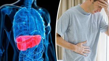 من مطبخك.. خضروات طبيعية تساعد في علاج الكبد الدهني سريعا