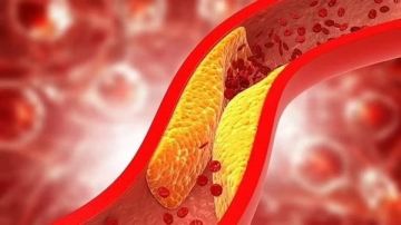 هل استخدام أدوية الكوليسترول له أثار جانبية؟ إليك أبرز هذه الأثار وكيفية التعامل معها