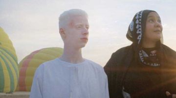 ضي ترند هز المشاعر والقلوب.. اعرف أهم التحديات أمام مرضى المهق