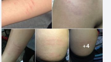 حبسته في الفصل وضربته بالعكاز مدرسة تعتدي على طالب بمدرسة بشبرا ووالدته تستغيث حبسته في الفصل وضربته بالعكاز مدرسة تعتدي على طالب بمدرسة بشبرا ووالدته تستغيث