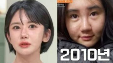 هوس عمليات التجميل.. امرأة كورية تجري 400 عملية تجميل خلال 15 عاما هوس عمليات التجميل.. امرأة كورية تجري 400 عملية تجميل خلال 15 عاما