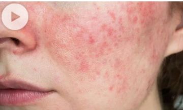 نشرة المرأة والمنوعات مشروبات الطاقة خطر يهدد صحة القلب والمخ.. ماذا يحدث لجسمك عند تناول البطاطس المحمرة؟