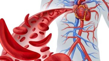 هل تحمل بكتيريا الأمعاء مفتاح علاج فقر الدم المنجلي؟ مفاجأة علمية