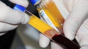 غرامة 5 ملايين جنيه عقوبة قبول التبرع بالدم من عديم الأهلية أو ناقصها غرامة 5 ملايين جنيه عقوبة قبول التبرع بالدم من عديم الأهلية أو ناقصها
