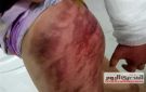 بسبب طلبها شراء كراسه.. حبس أب 4 أيام بتهمة تعذيب طفلته بكفر الشيخ - eg