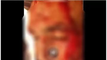 ضبط المتهمين بالتعدي على شخص لرفضه التنازل عن قضية بالدقهلية