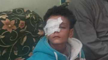 محافظ قنا يوجه بمتابعة حالة الطفل المصاب داخل مدرسة وتقديم تقرير للنيابة