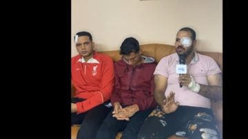 أحد جيران مشاجرة شبرا الخيمة: رموا علينا مية نار.. عيني باظت وجسمي اتسلخ