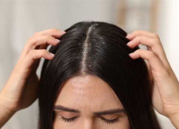 بالخل بدل المنتجات الكيميائية.. إزاي تتخلصي من قشرة الشعر بطريقة طبيعية بالخل بدل المنتجات الكيميائية.. إزاي تتخلصي من قشرة الشعر بطريقة طبيعية