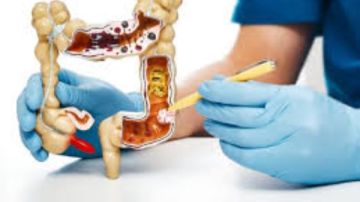 7 خطوات لتطهير القولون بشكل طبيعي للحفاظ على صحته ووظيفته
