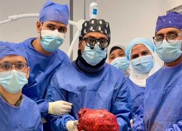 استئصال ورم يزن 6 كيلوجرامات لسيدة بمستشفى السلام التابعة لـ الرعاية الصحية ببورسعيد استئصال ورم يزن 6 كيلوجرامات لسيدة بمستشفى السلام التابعة لـ الرعاية الصحية ببورسعيد