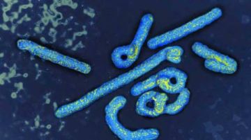 7 معلومات عن فيروس ماربورج.. ما لا تعرفه عنه