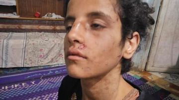 حبس أب وزوجته لتعذيبهما ابنته في المنوفية