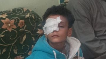 تقرير عاجل للنيابة..محافظ قنا يتابع حالة الطفل المصاب داخل مدرسة صور تقرير عاجل للنيابة..محافظ قنا يتابع حالة الطفل المصاب داخل مدرسة صور