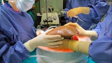 أستاذ زراعة كبد: مصر تبدي اهتماما غير مسبوق بمبادرة مكافحة فشل الأعضاء أستاذ زراعة كبد: مصر تبدي اهتماما غير مسبوق بمبادرة مكافحة فشل الأعضاء