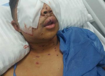 بسبب تيك توك .. إصابة شاب بطلق ناري في بورسعيد.. والأمن يضبط الجاني