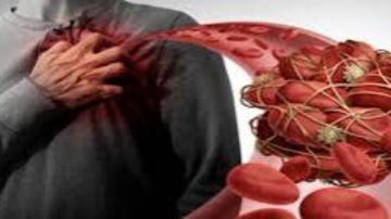 عراض مؤلمة لإرتفاع الكوليسترول.. ما هي وكيفية التخلص منها