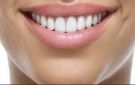 ابتسامة مشرقة: طرق طبيعية لتبييض الأسنان