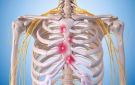 ما أسباب حدوث ألم في عظام القفص الصدري عند الضغط عليها؟