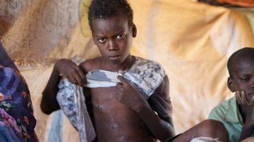 أطفال ونساء السودان بلا أمان.. نوبات هلع وكوابيس يومية داخل مراكز النزوح أطفال ونساء السودان بلا أمان.. نوبات هلع وكوابيس يومية داخل مراكز النزوح