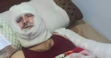 ضبط المتهمين بإشعال النيران فى شخص أمام زوجته وإصابته بحروق خطيرة ضبط المتهمين بإشعال النيران فى شخص أمام زوجته وإصابته بحروق خطيرة