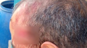 السبب غريب.. القصة الكاملة لتعدي ولي أمر على معلم داخل مدرسة بنات بالإسماعيلية السبب غريب.. القصة الكاملة لتعدي ولي أمر على معلم داخل مدرسة بنات بالإسماعيلية