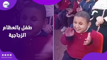 طفل بعظام زجاجية.. تعاطف واسع وتحركات لإنقاذ زياد من مرض نادر طفل بعظام زجاجية.. تعاطف واسع وتحركات لإنقاذ زياد من مرض نادر