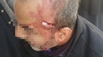 ضربه بالمقص.. القصة الكاملة لاعتداء ولي أمر على معلم بالإسماعيلية عاجل ضربه بالمقص.. القصة الكاملة لاعتداء ولي أمر على معلم بالإسماعيلية عاجل