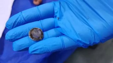 استخراج بطارية ابتلعها طفل 5 سنوات بمستشفى أبوكبير بالشرقية