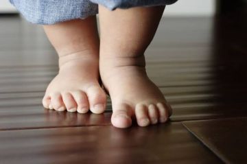 أعراض مرض الكساح وعلاقته بفيتامين شهير