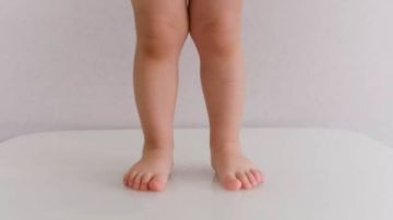 نشرة المرأة والمنوعات أعراض مرض الكساح وعلاقته بفيتامين شهير.. طعام يحمي من السرطان والسكري والضغط نشرة المرأة والمنوعات أعراض مرض الكساح وعلاقته بفيتامين شهير.. طعام يحمي من السرطان والسكري والضغط