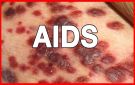 اختراع دواء جديد يقضي على مرض الإيدز