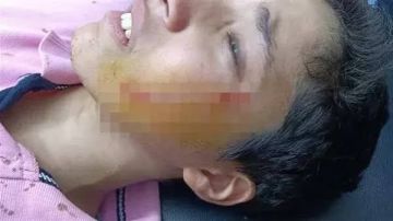 قرار عاجل بشأن محاكمة طالب شوه وجه زميله بـ27 غرزة بالبدرشين