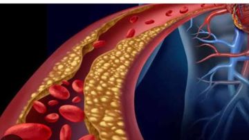 6 خيارات شائعة في وجبة الإفطار تؤدي لارتفاع الكوليسترول.. تجنبها فورا 6 خيارات شائعة في وجبة الإفطار تؤدي لارتفاع الكوليسترول.. تجنبها فورا