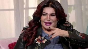 الفنانة نجوى فؤاد تكشف تفاصيل كسر ذراعها