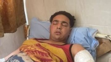 رئيس جامعة طنطا ينقل عامل السيرك المصاب لمستشفي جراحات اليوم الواحد