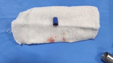 فريق طبي بمستشفى القلب الجامعي بأسيوط ينجح في إنقاذ حياة طفلة