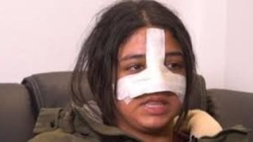 اعوجاج بالأنف.. مفاجأة بشأن الطالبة كارما ضحية طالبات التجمع الخامس