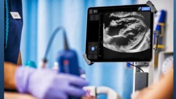 حدث فريد.. فريق طبي ينقذ حياة فتاة من اختناق القلب بالإسكندرية