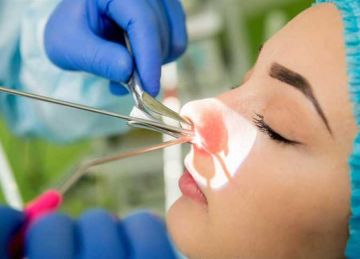 بواسطة بالون.. تقنية جديدة لتوسيع الجيوب الأنفية تشعل التواصل الاجتماعي (فيديو)