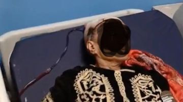 مستشفى سوهاج الجامعي تجري عملية معقدة لمسنة مطعونة بالفأس