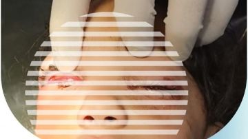 الكحل المؤذي.. فريق طبي ينقذ عيون 3 صغار بكفر الشيخ الكحل المؤذي.. فريق طبي ينقذ عيون 3 صغار بكفر الشيخ